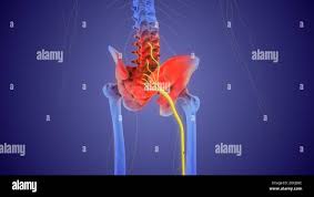Download Sciatic nerve pain pictures 347 images227