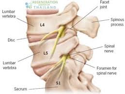 Download Sciatic nerve pain pictures 288 images228