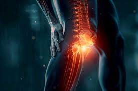 Download Sciatic nerve pain pictures 337 images236