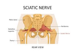 Download Sciatic nerve pain pictures 366 images239