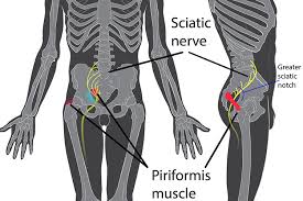 Download Sciatic nerve pain pictures 131 images242