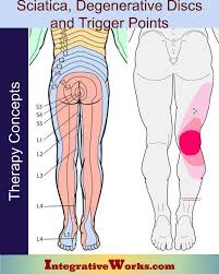 Download Sciatic nerve pain pictures 129 images243