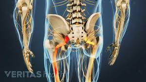 Download Sciatic nerve pain pictures 141 images251