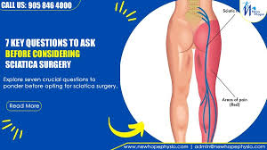 Download Sciatic nerve pain pictures 102 images252