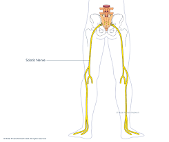 Download Sciatic nerve pain pictures 348 images255