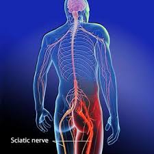 Download Sciatic nerve pain pictures 201 images256