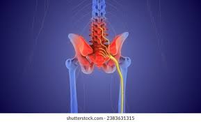 Download Sciatic nerve pain pictures 379 images257