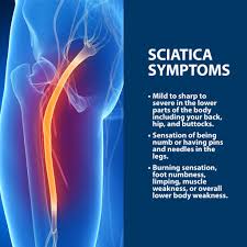 Download Sciatic nerve pain pictures 180 images261
