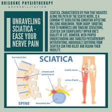 Download Sciatic nerve pain pictures 125 images262