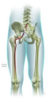 Download Sciatic nerve pain pictures 329 images267
