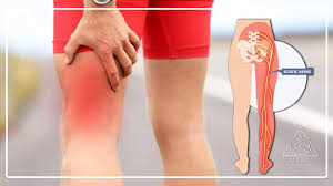Download Sciatic nerve pain pictures 193 images31