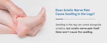 Download Sciatic nerve pain pictures 335 images34