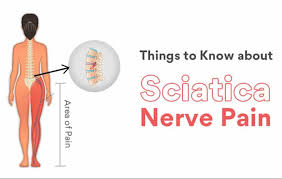 Download Sciatic nerve pain pictures 228 images37