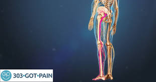 Download Sciatic nerve pain pictures 272 images4