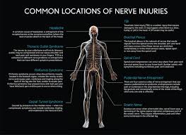 Download Sciatic nerve pain pictures 157 images41