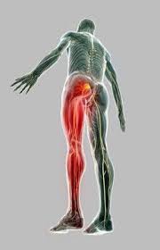Download Sciatic nerve pain pictures 373 images46