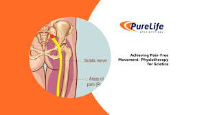 Download Sciatic nerve pain pictures 294 images47