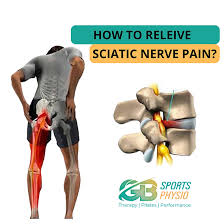 Download Sciatic nerve pain pictures 144 images5