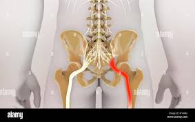 Download Sciatic nerve pain pictures 323 images54