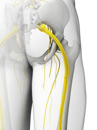 Download Sciatic nerve pain pictures 259 images57