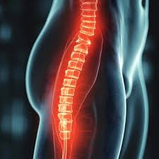 Download Sciatic nerve pain pictures 287 images6
