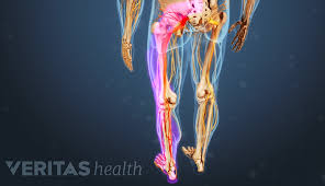Download Sciatic nerve pain pictures 220 images63