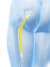 Download Sciatic nerve pain pictures 334 images64