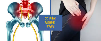 Download Sciatic nerve pain pictures 127 images70