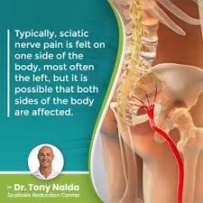 Download Sciatic nerve pain pictures 142 images78