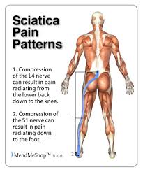 Download Sciatic nerve pain pictures 167 images85