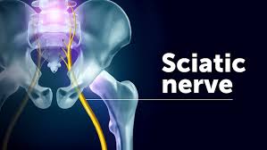 Download Sciatic nerve pain pictures 285 images9