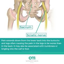 Download Sciatic nerve pain pictures 217 images92