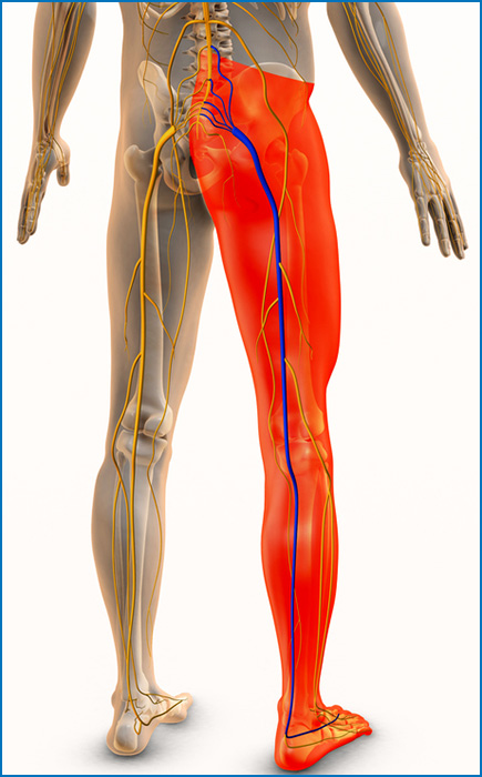 Download Sciatic nerve pain pictures 32 sciatic nerve pain illustration