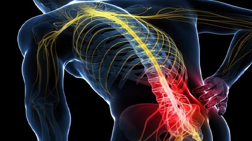 Download Sciatic nerve pain pictures 61 sciatica lower back pain